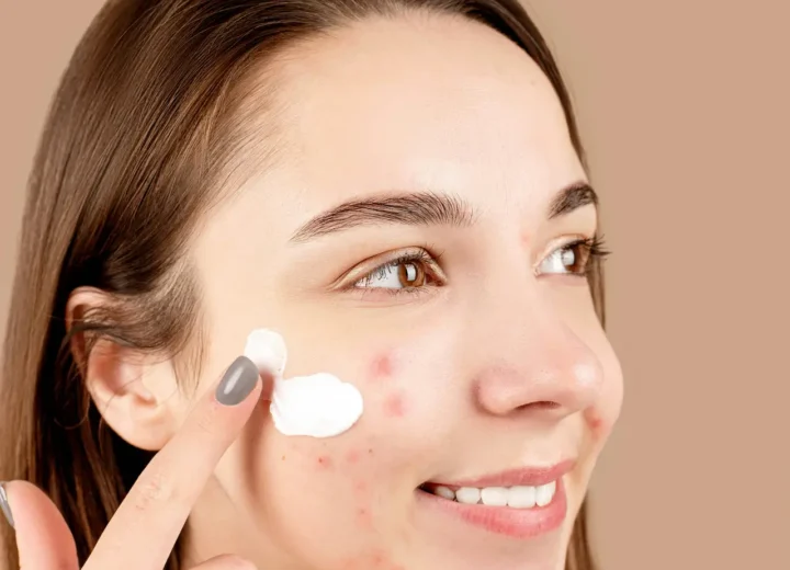 Konsultacja dermatologiczna - kobieta pokazująca dermatologowi zmiany skórne na twarzy